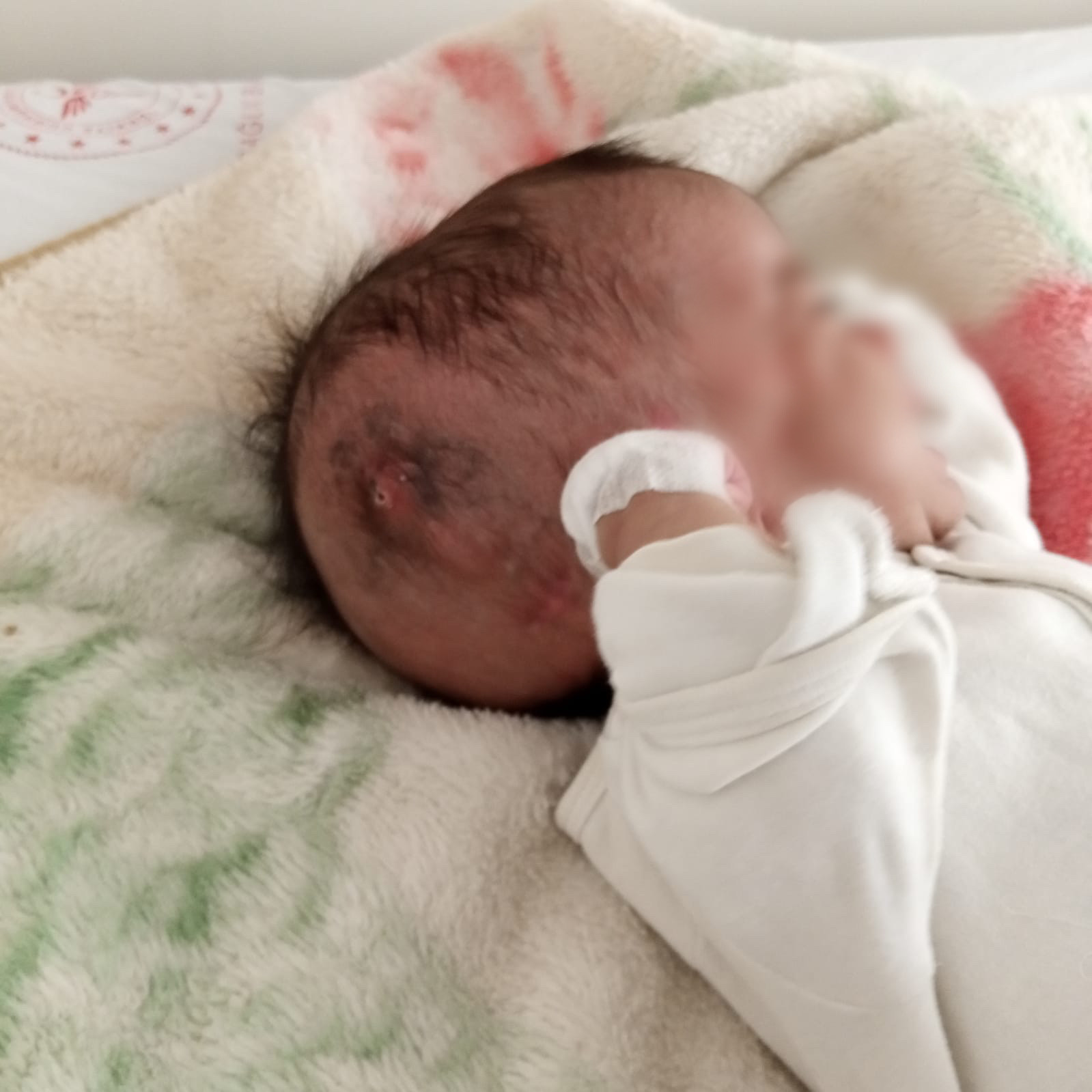 Husain is a newborn needs your urgent help to complete his treatment