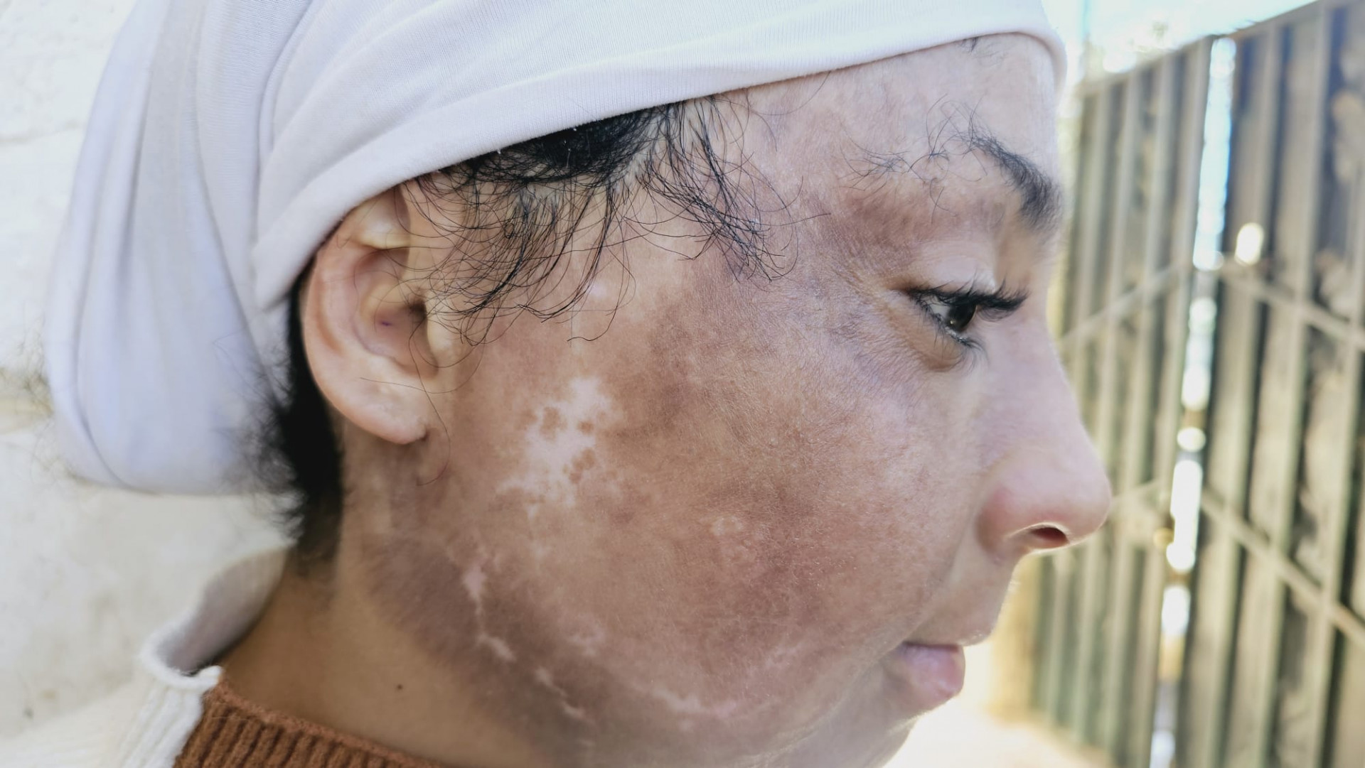 Let's support Sumaya and help her overcome her difficult circumstances.