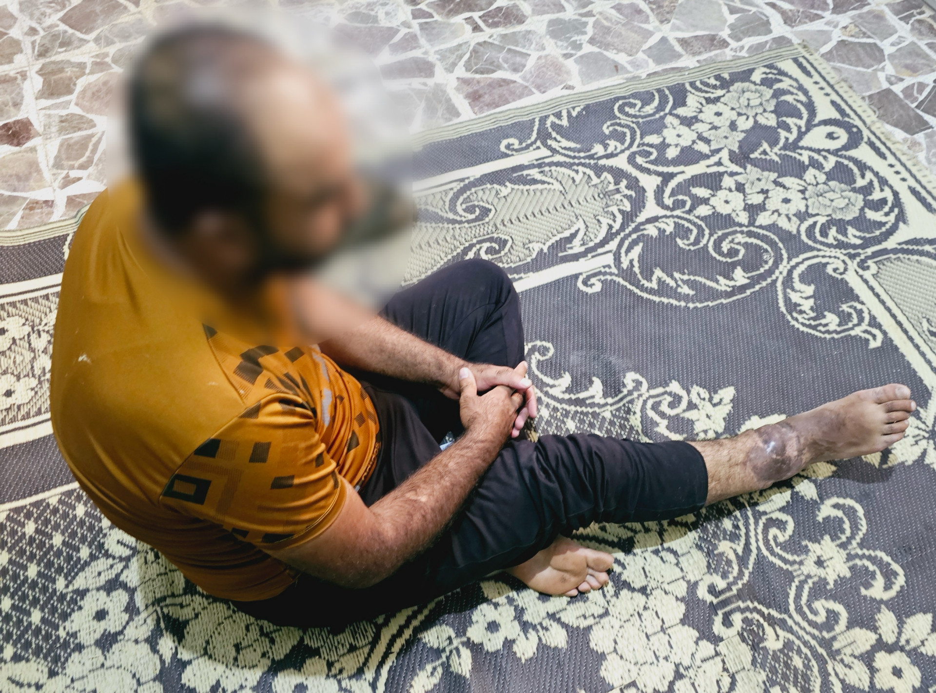 Help Majed and His Family Overcome the Harsh Conditions of War and Disability