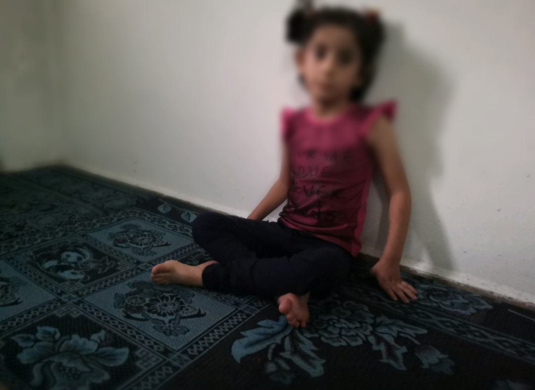 A baby girl suffers from a problem with her jaw