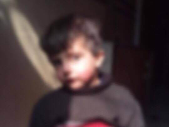Child need heart stent