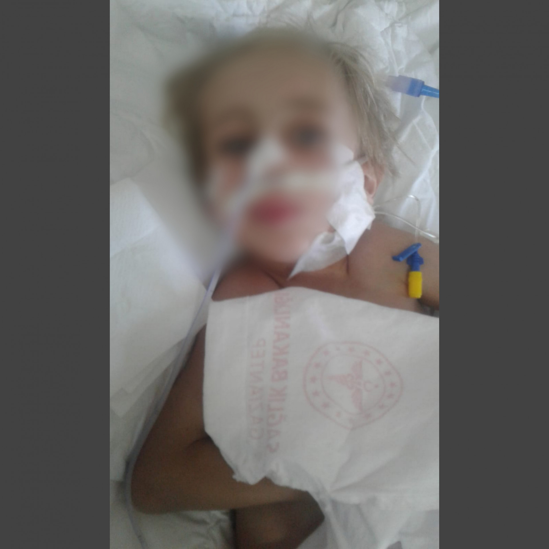 Hamza is with hypoxia at the ICU