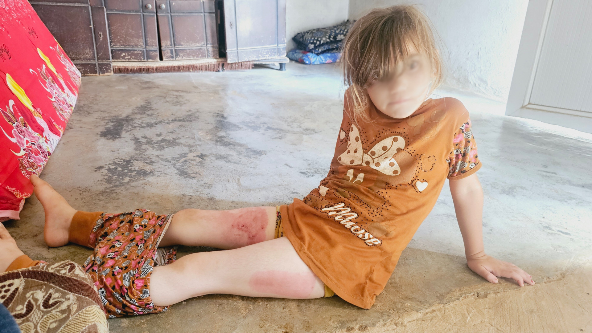 After enduring multiple displacements, their situation has become increasingly desperate.