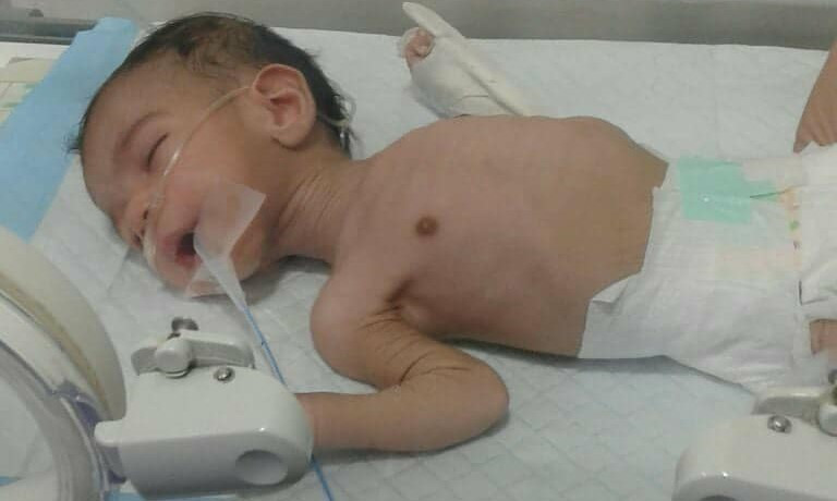 A Baby in Need of a Stomach Surgery