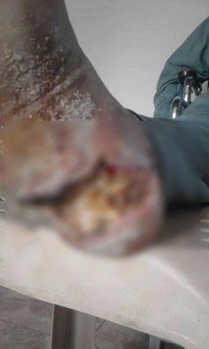 Patient needs Urgent surgery