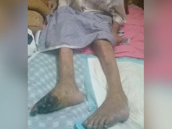 A Patient Needs Treatment Expenses