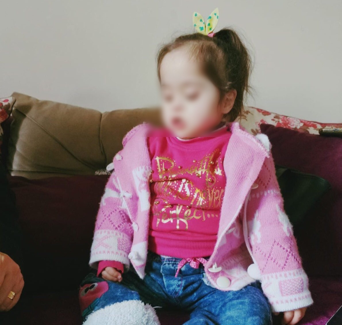 طفلة مصابة بمتلازمة داون