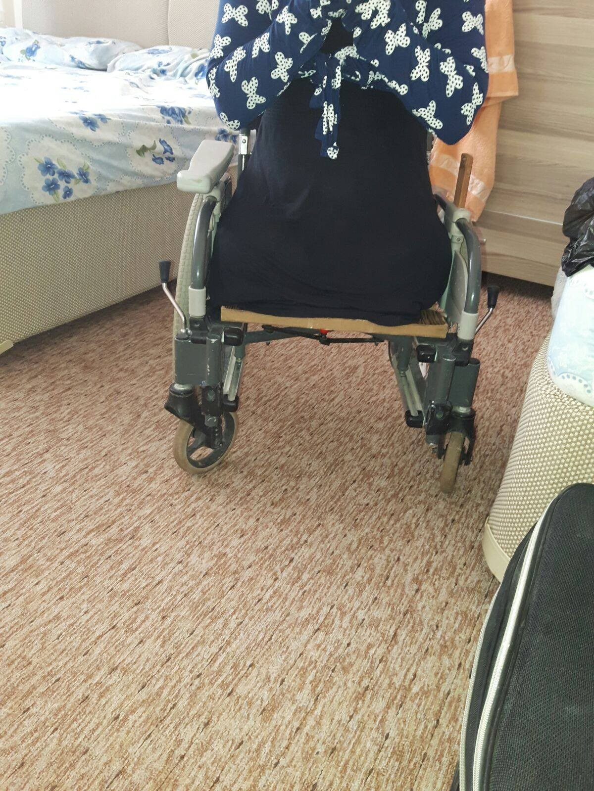 Young lady with amputated lower limbs
