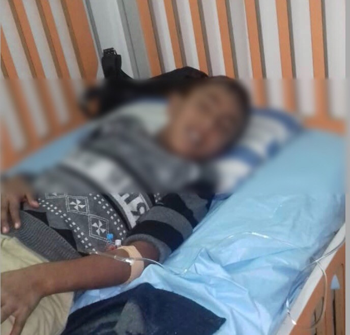 طفل يعاني الكثير من داء أديسون