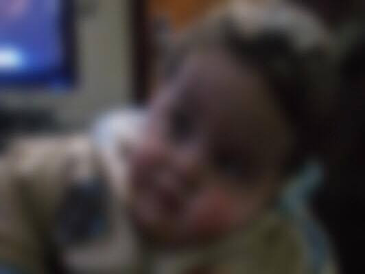 Child need treatment costs
