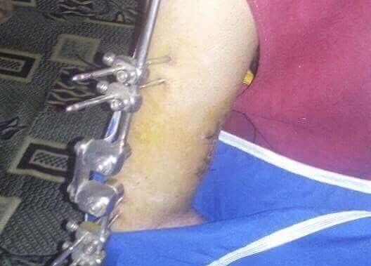Young man needing urgent surgery