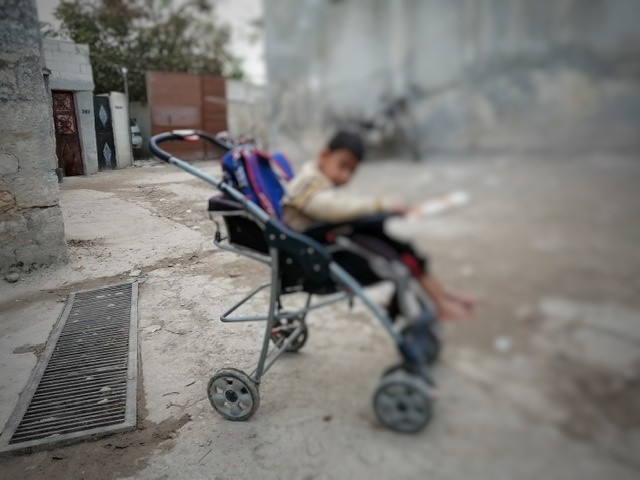 A child with spinal atrophy and hypoxia