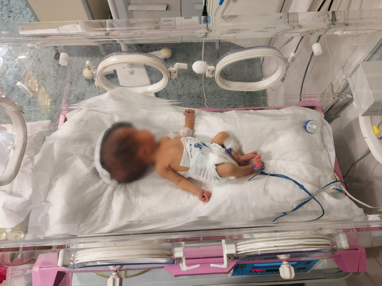 Mohammad is sick and needs medica device