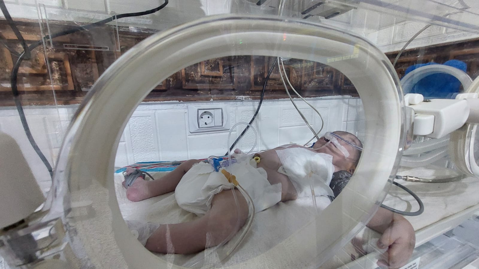 Help Baby Kawthar Complete Her Journey to Health