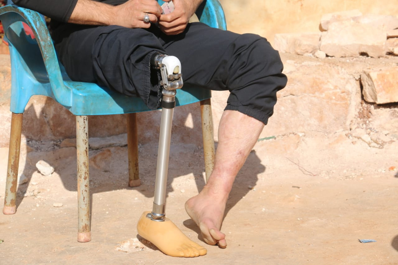 A young man with amputated leg