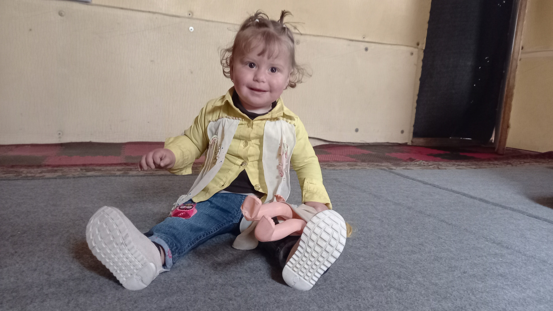 Gharam has congenital deformity and needs surgery.