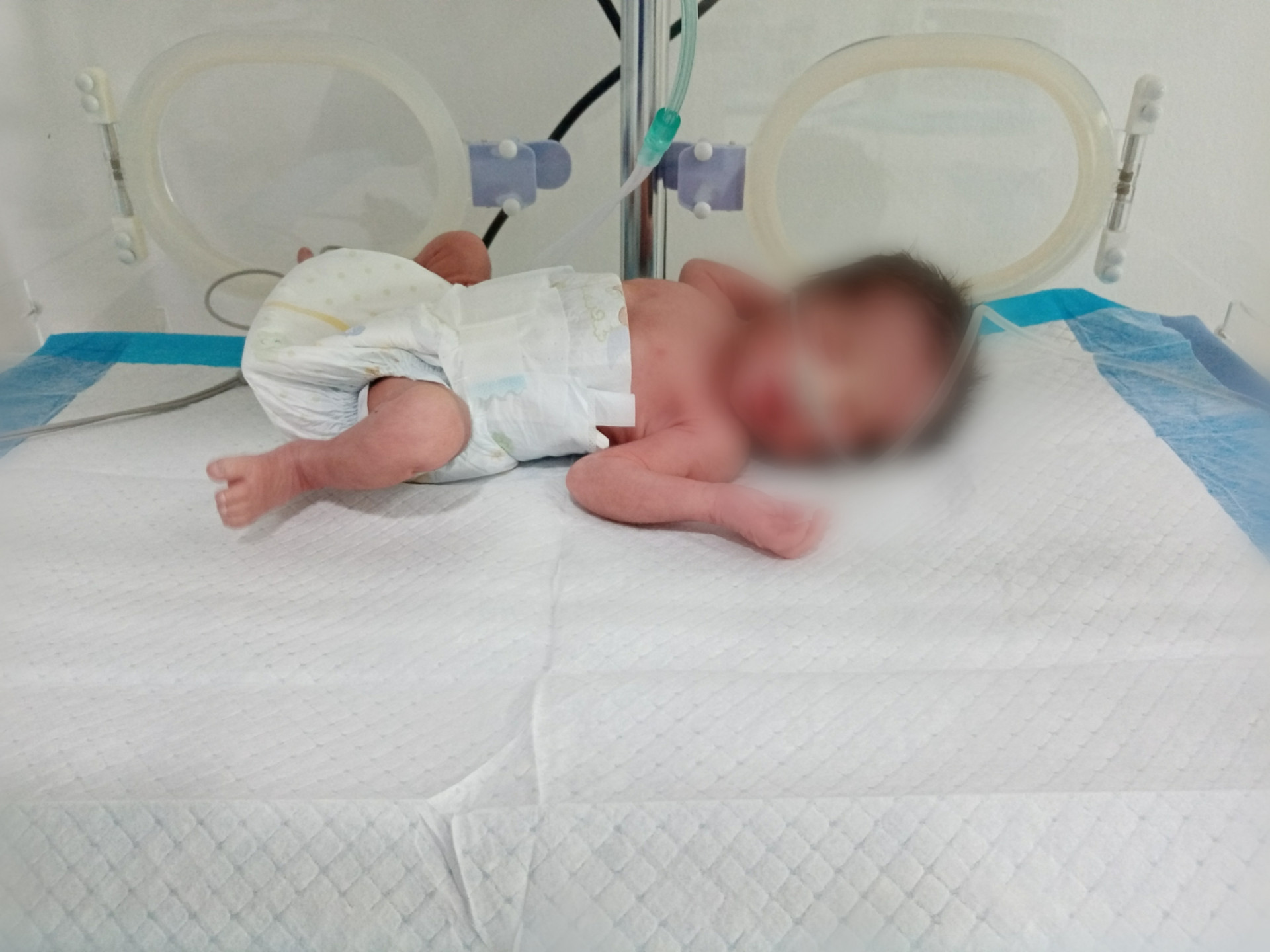 Baby girl desperately needs an incubator