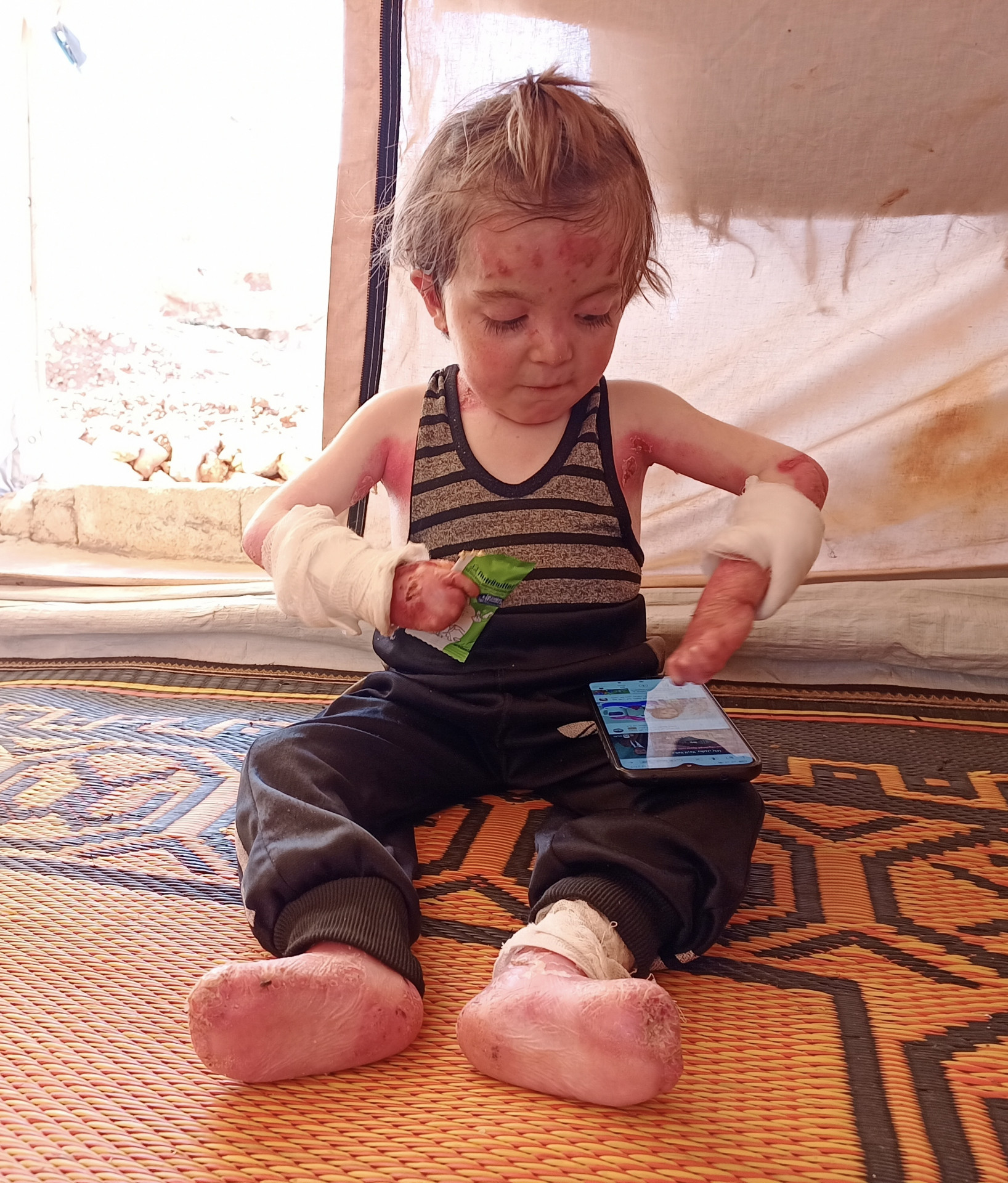 A child born with a skin disease.