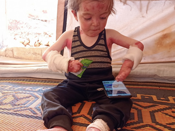 A child born with a skin disease.