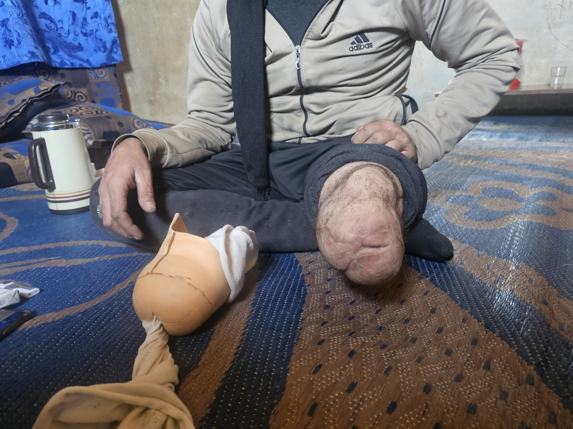 من يساندُ أبا أنهكتهُ الإصابة والحياة ؟