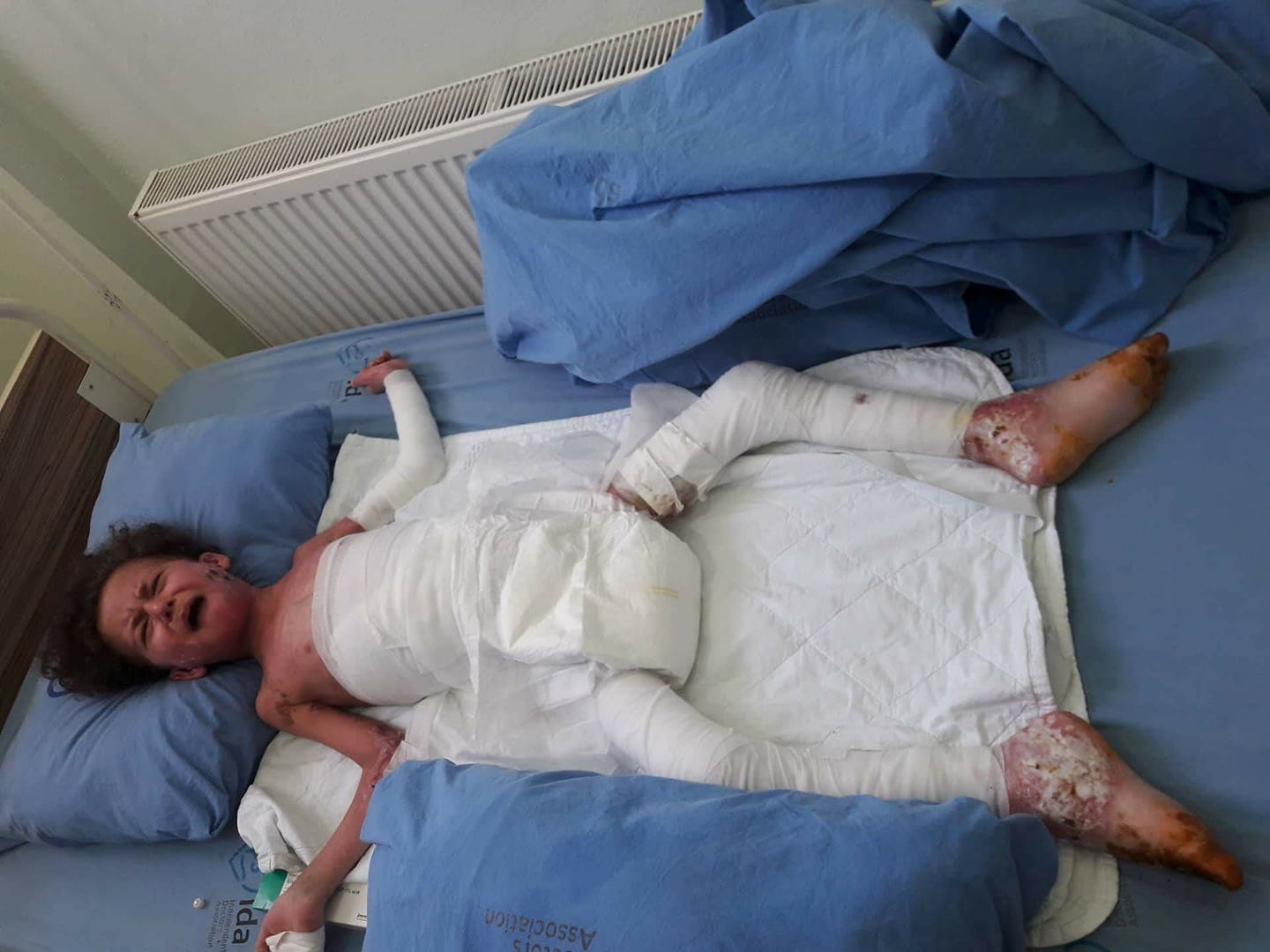 A Child Needs urgent treatment