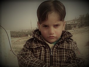 A Child with Sever Hearing Loss