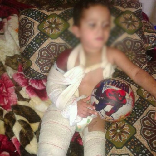 A Child Needs a Surgical Operation
