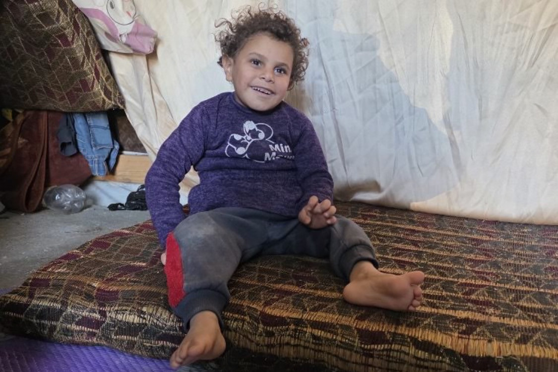 شلل دماغي يقيّد طفولة حلا