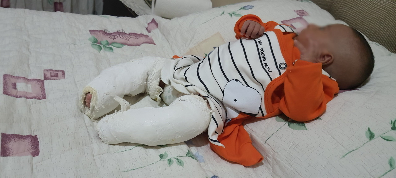 Kareem was born with a deformity, needs urgent surgery