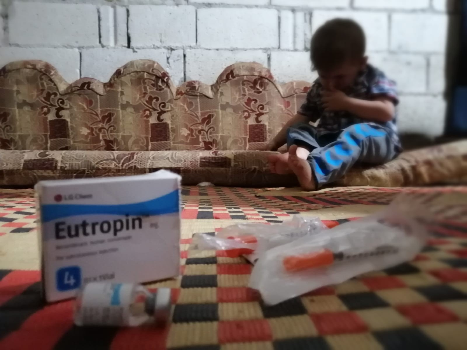 طفل يعاني من ضمور في الغدة الدرقية