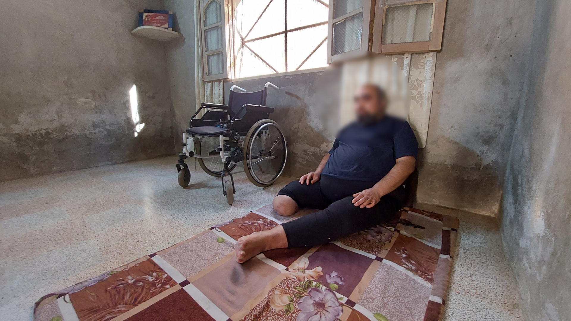 He was wounded by a war, his leg was amputated and he can no longer provide for his family.