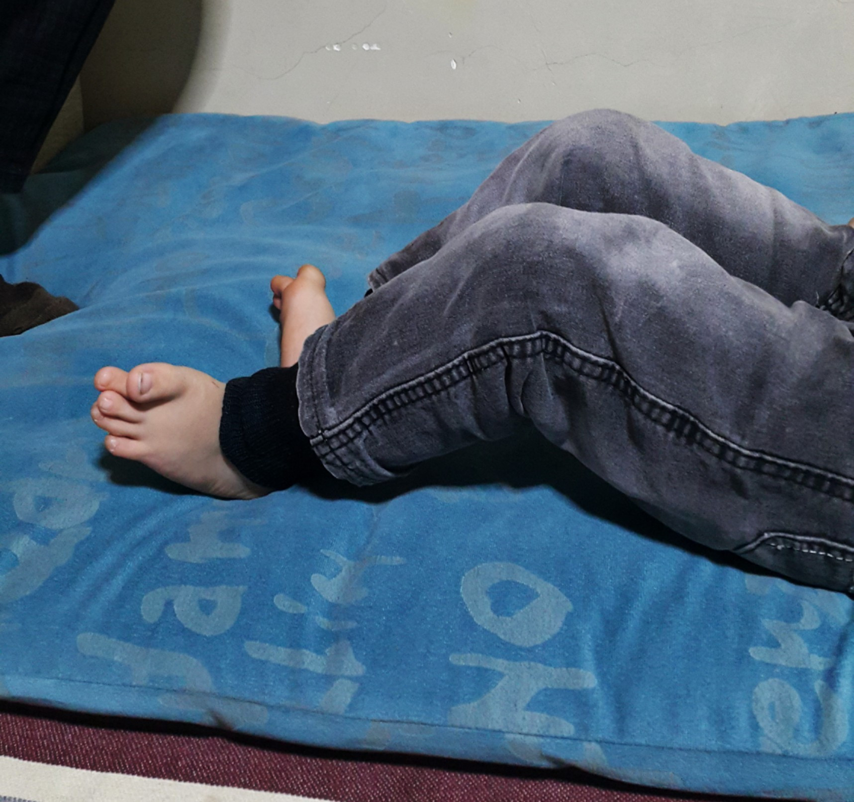 طفل لديه تشوه خلقي في الأطراف!