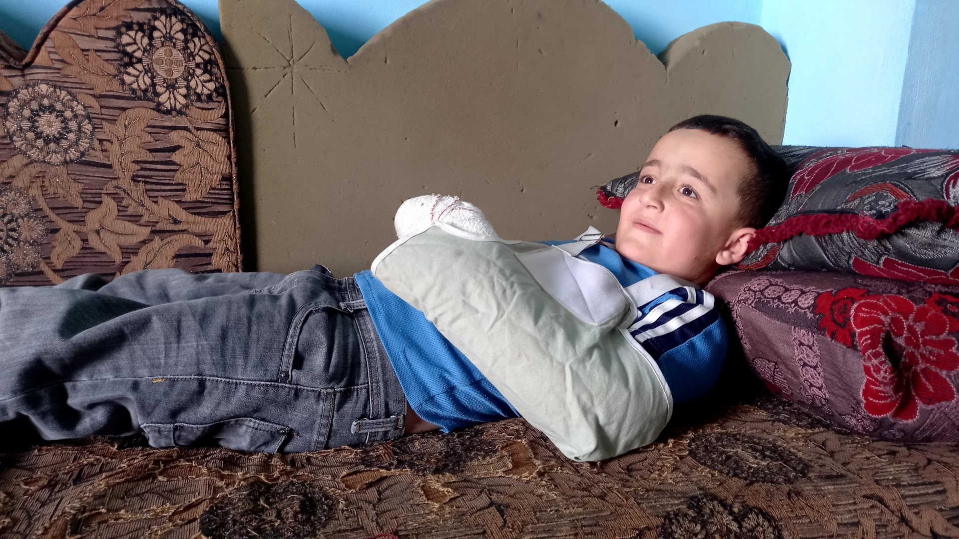 He broke his hand while playing and his family lives in challenging circumstances!