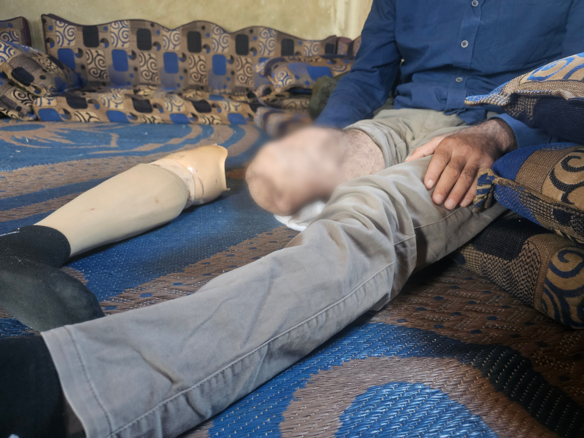 A Father Amputated and Unable to Provide for His Two Children