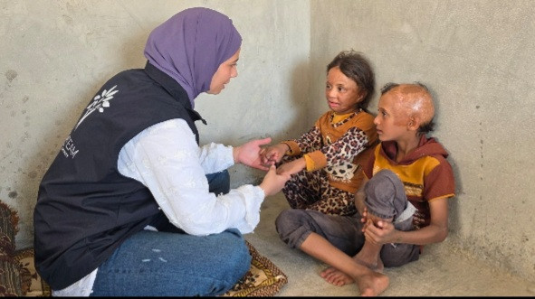 نارٌ غيّرت ملامح الطفولة ...