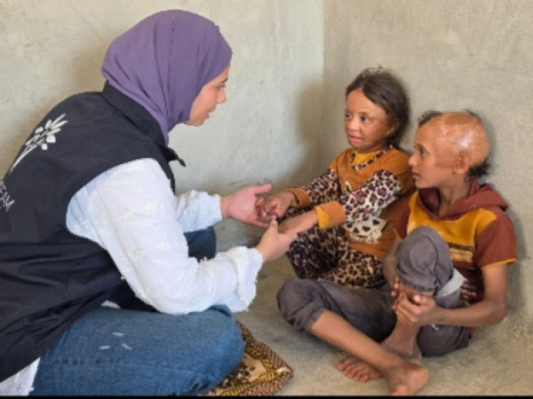 نارٌ غيّرت ملامح الطفولة ...