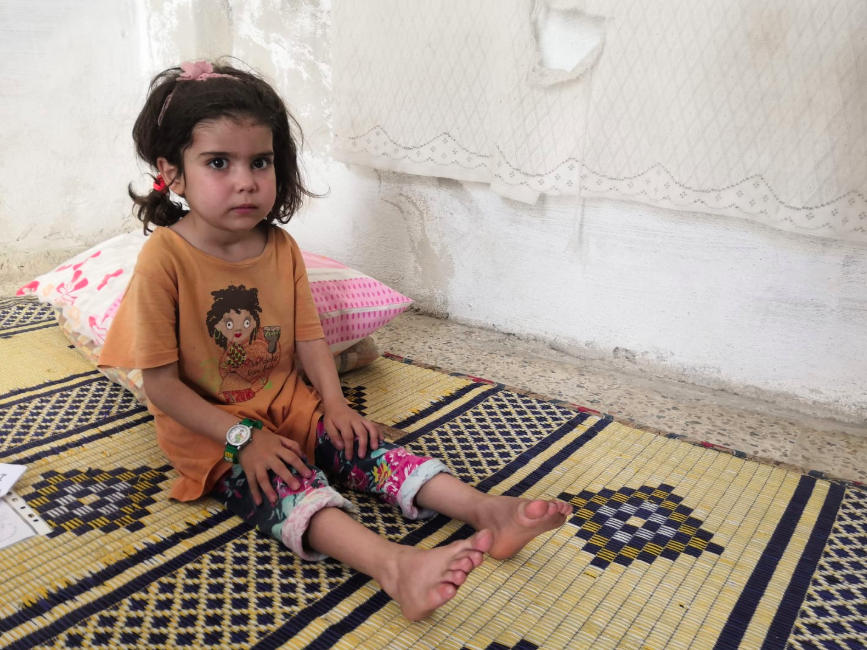 A girl child suffers from pulmonary fibrosis