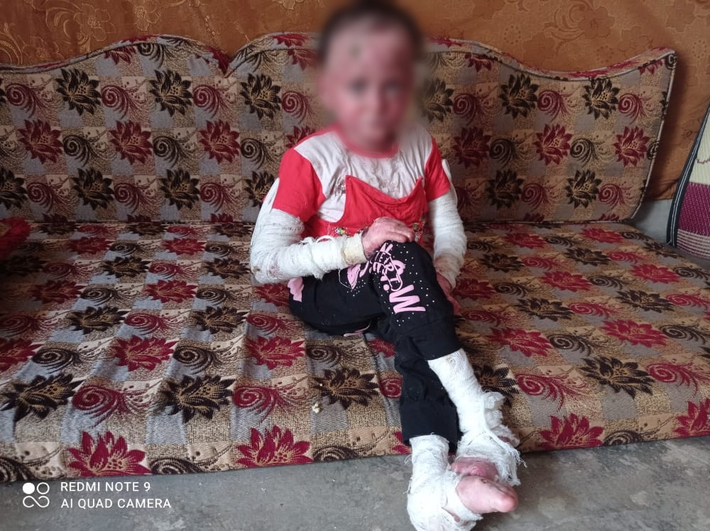 A girl suffering from a chronic congenital skin disease