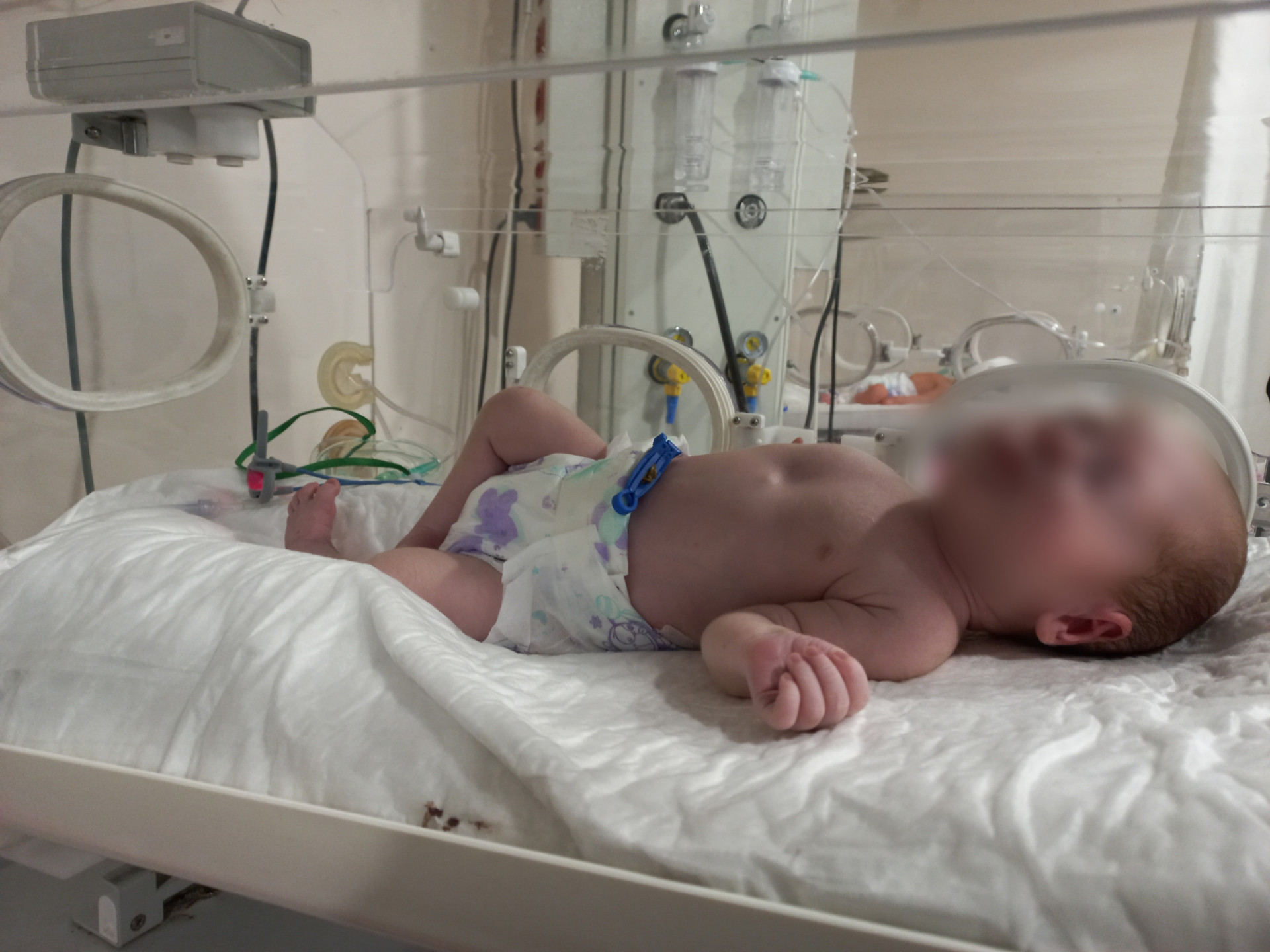 Hussain suffers from hydrocephalus and needs a cerebral shunt