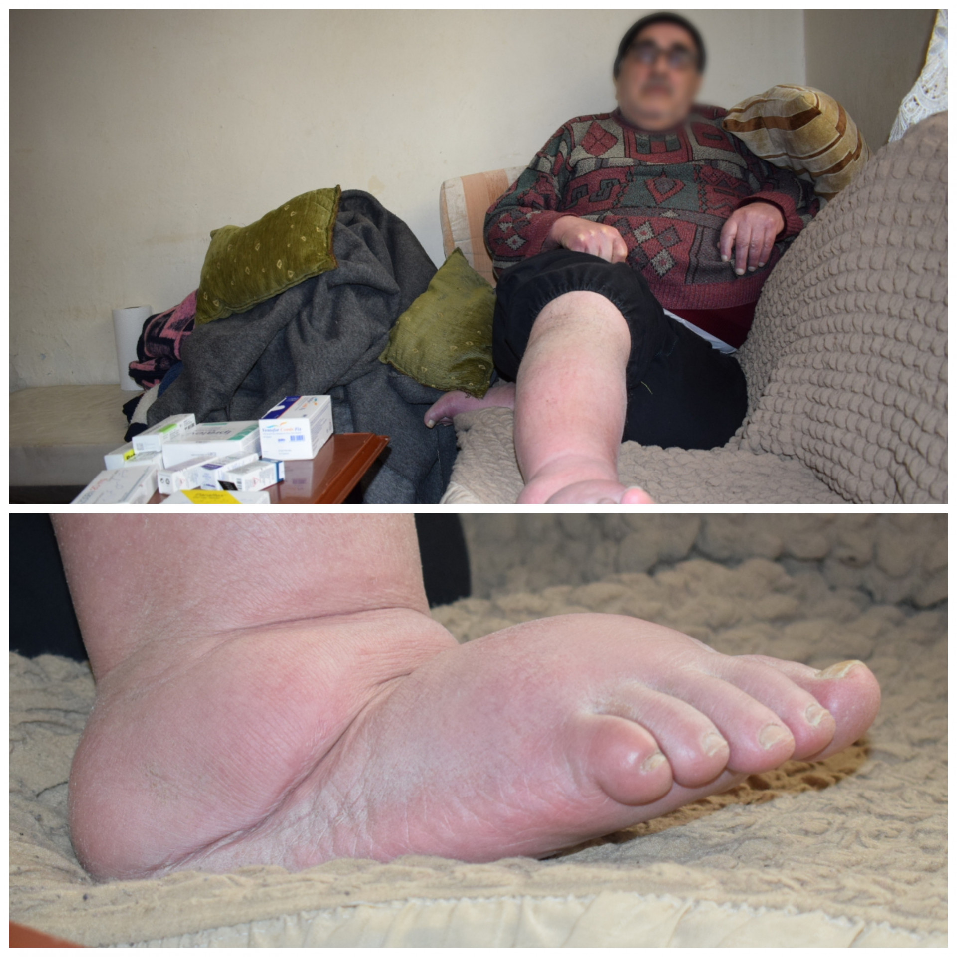 Mohammed suffers from leg ischemia that made him unable to move
