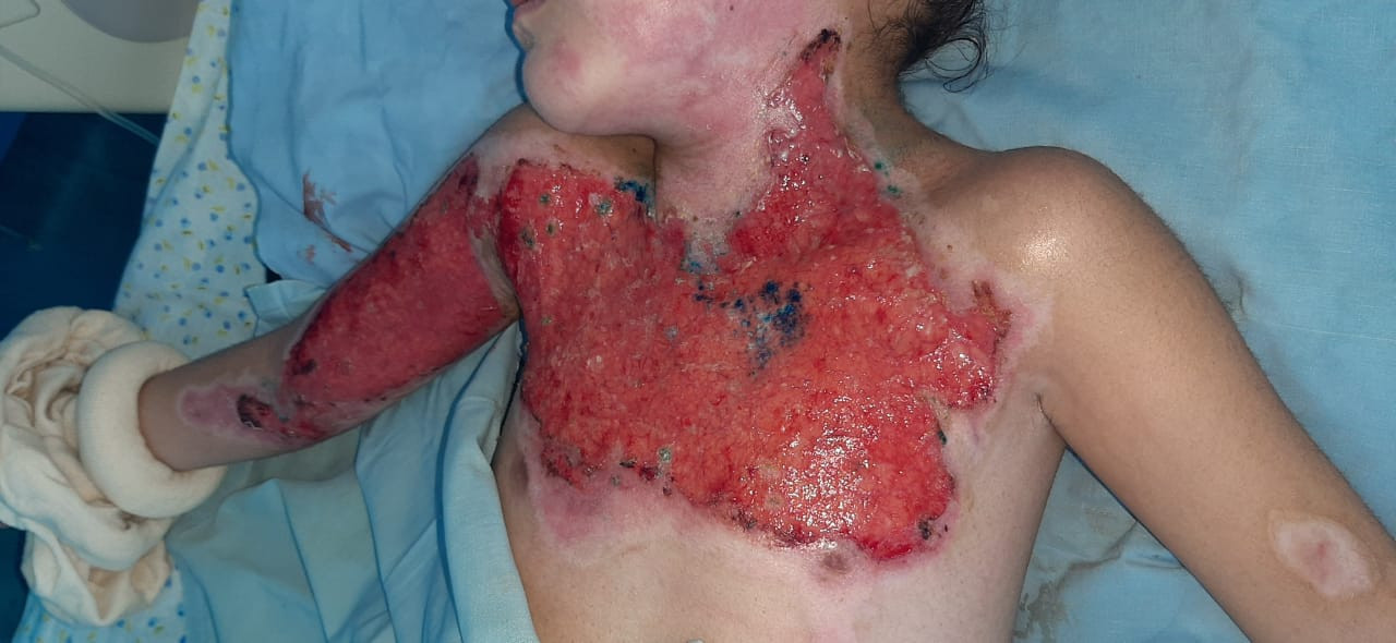 Zainab needs your support to have urgent treatment