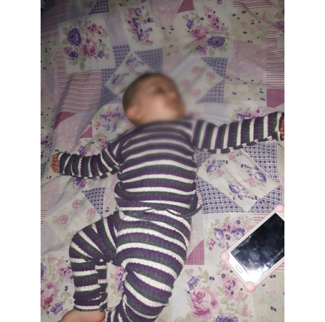 an infant with health problems