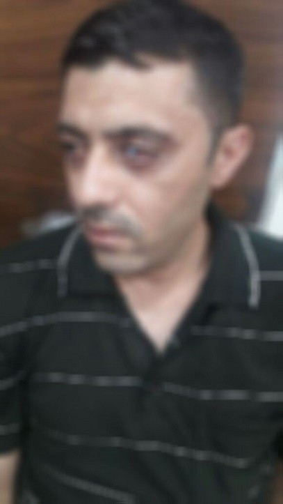 A Father in Need of an Installation of Artificial Eye