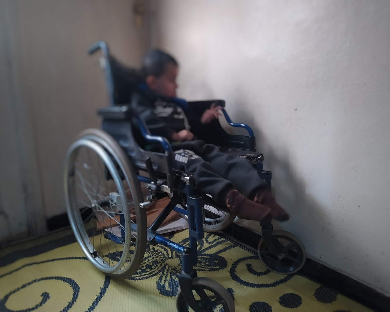 A little child with cerebral atrophy needs help