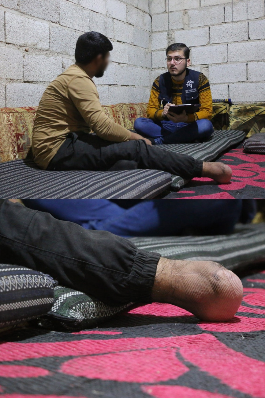 Mahmoud needs your help to undergo surgery!