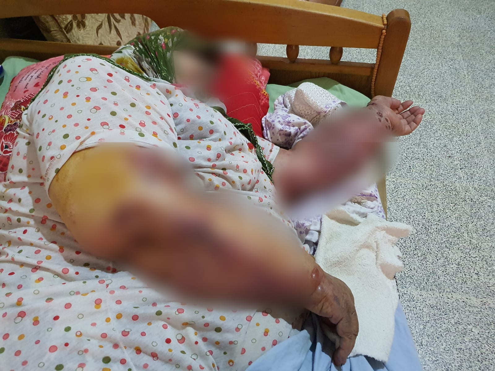 The illness is spreading across Aunt Naheda's body, and she urgently needs treatment.