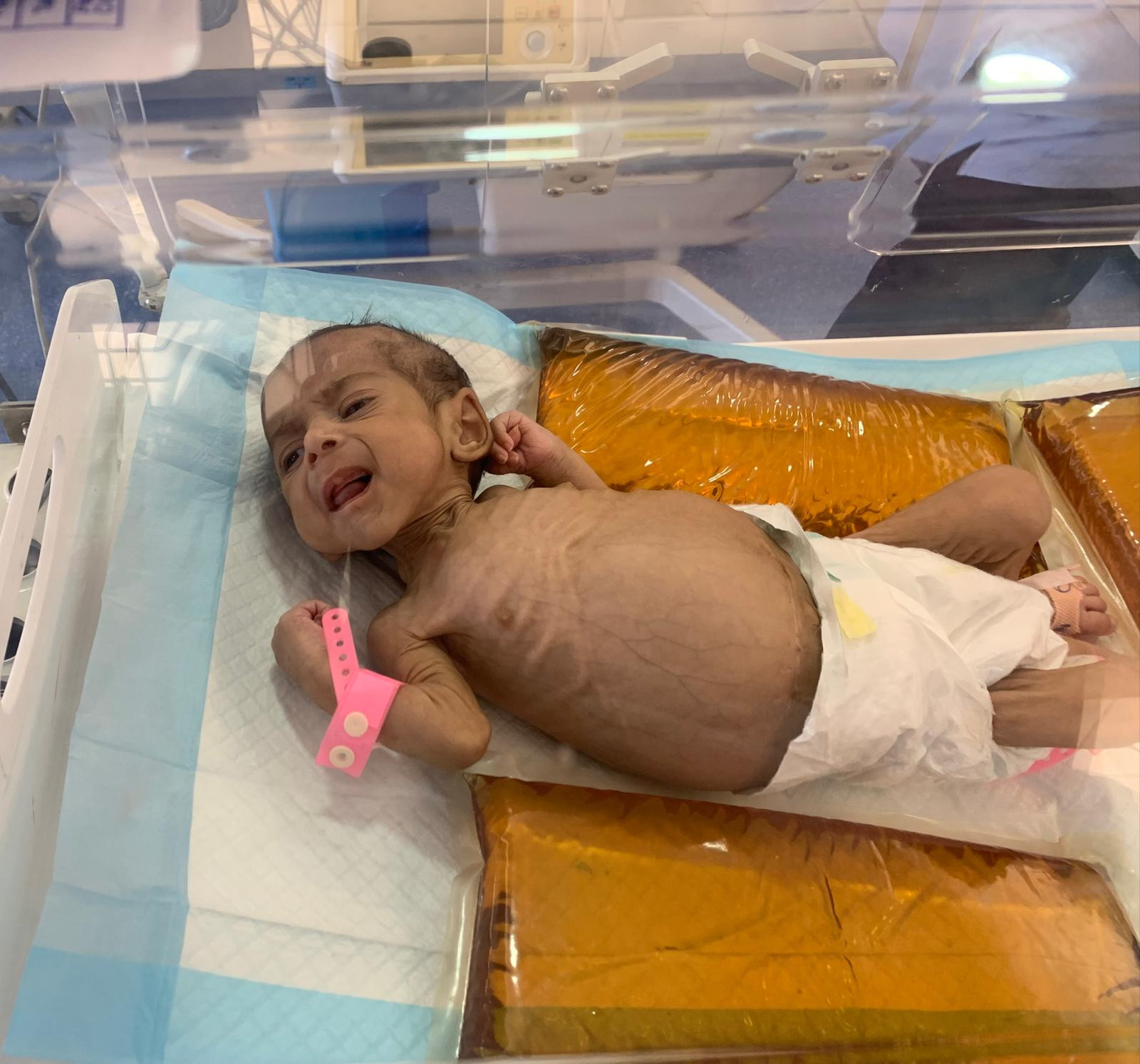 Baby Mariam needs your donations to survive!