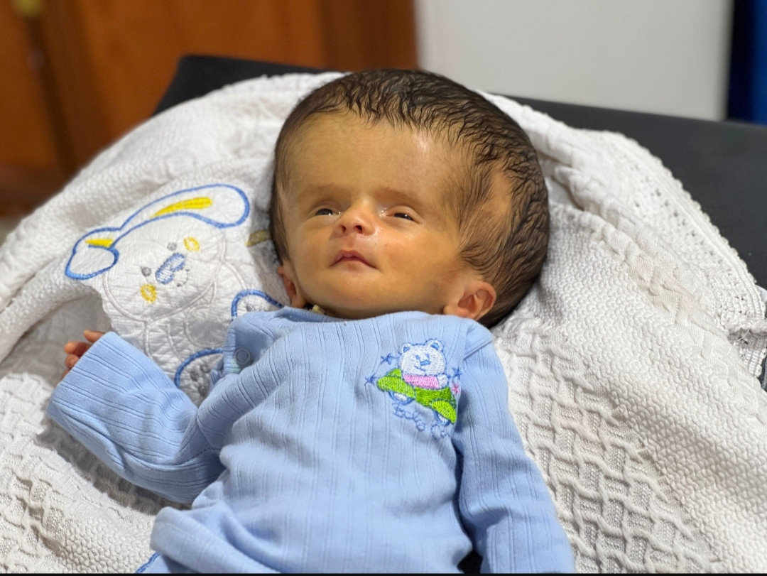 محمد... رضيع ينتظر فرصة لينجو
