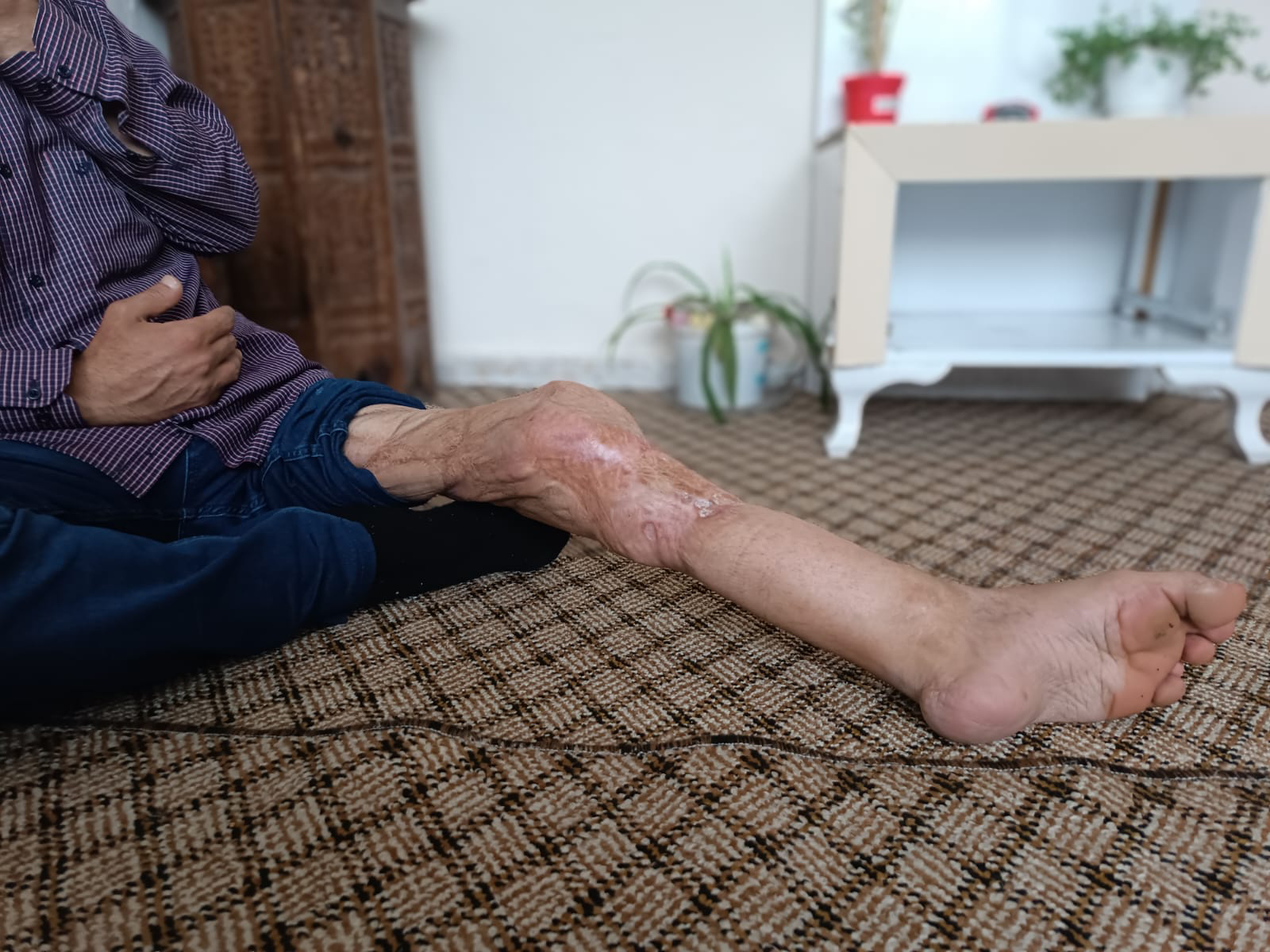 Ahmed, the head of a family, is in need of a helping hand.