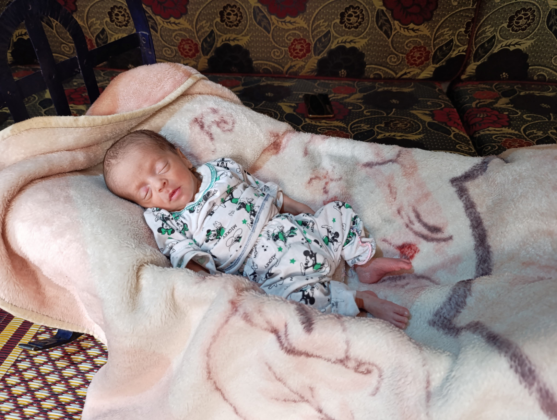 An Infant with Fluid on the Brain